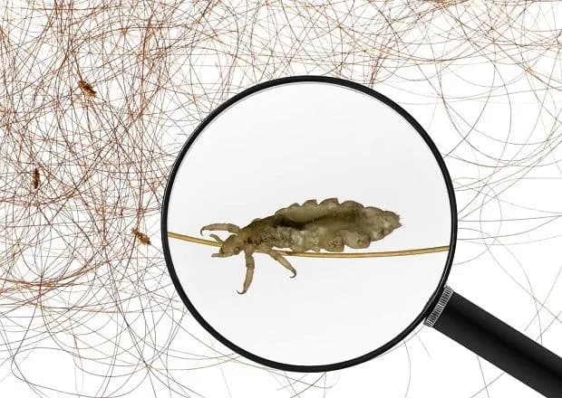 Wszy w snach – co oznaczają? Znaczenie i interpretacja marzeń sennych o wszach Wszy w snach – co oznaczają? Znaczenie i interpretacja marzeń sennych o wszach